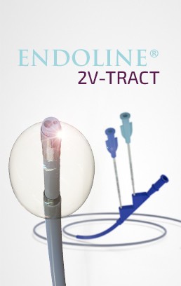 Image-Focus-Catheter-Ballonnet